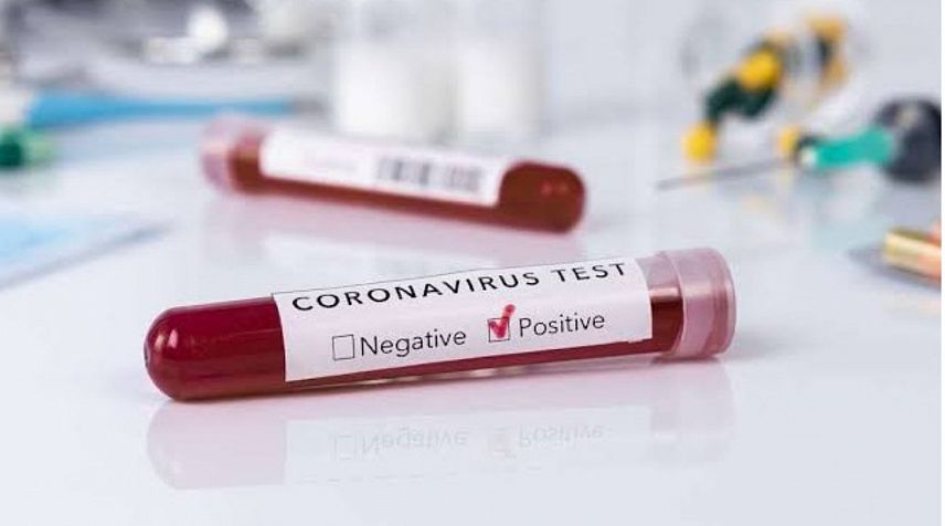 В Оренбуржье прибавилось 82 пациента с коронавирусом