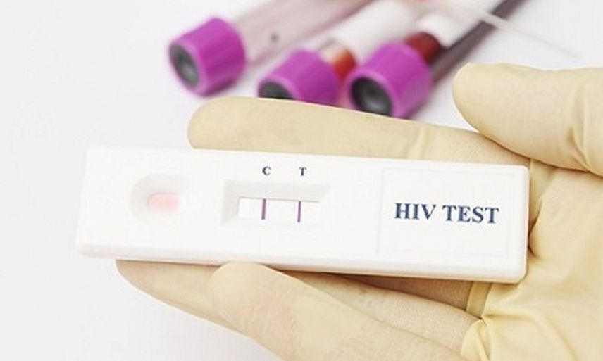 Жители Оренбуржья смогут сдавать тест на ВИЧ без очереди