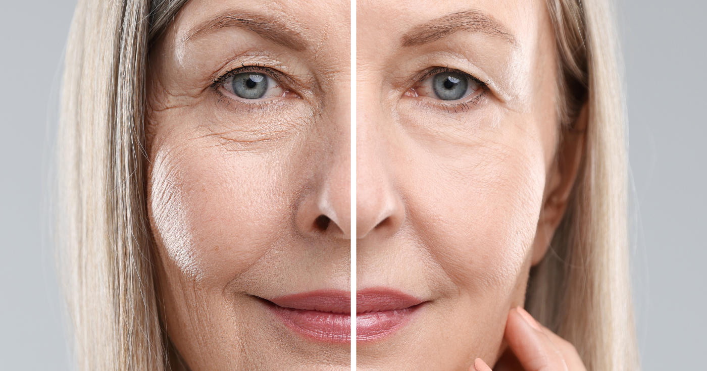 Морщинки от обезвоживания исчезли — новое средство Yves Rocher увлажняет и наполняет кожу в течение 100 часов